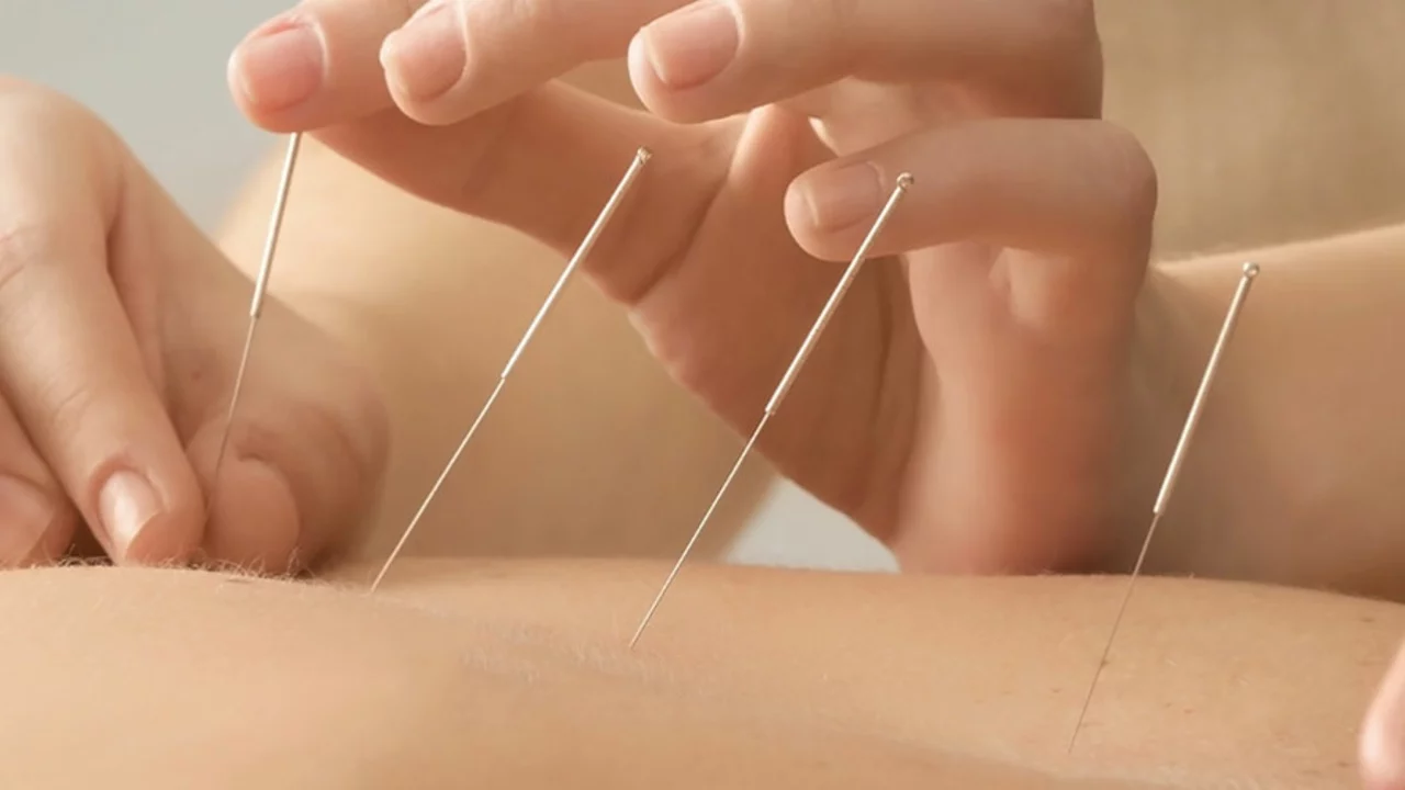 The Benefits of Acupuncture for Bladder Pain Relief